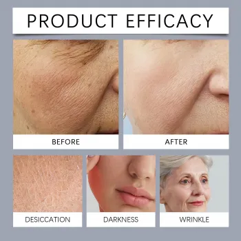 Hoygi Bee Venom Stick