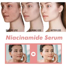 Hoygi Peach 70 Niacinamide Serum