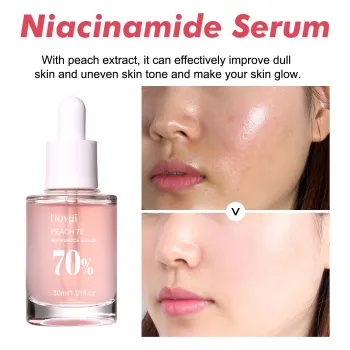 Hoygi Peach 70 Niacinamide Serum